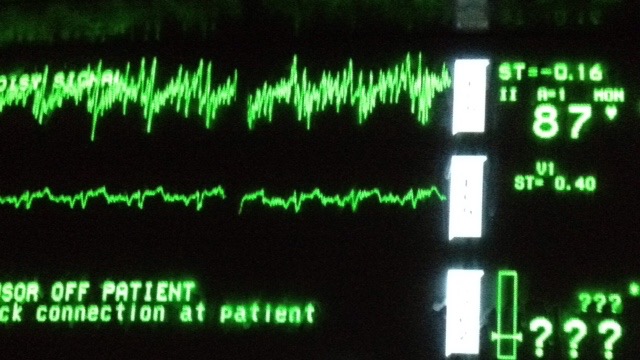heart-2